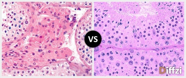 Leydig Cells vs Sertoli Cells