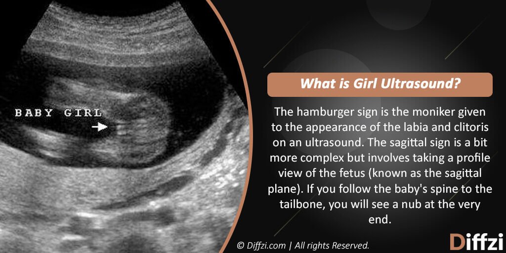 Girl Ultrasound