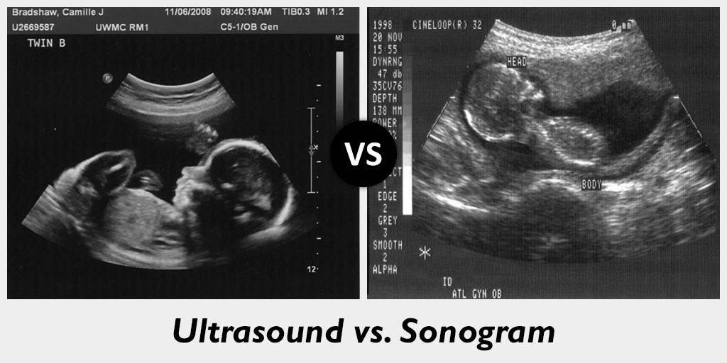 sonogram vs. ultrasound