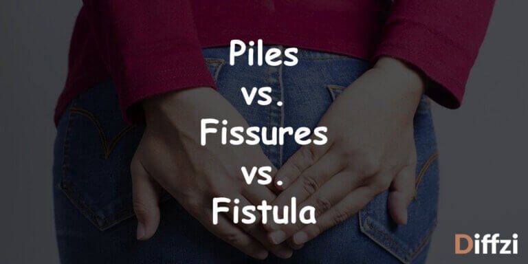 Difference Between Piles Vs Fissures Vs Fistula Diffzi