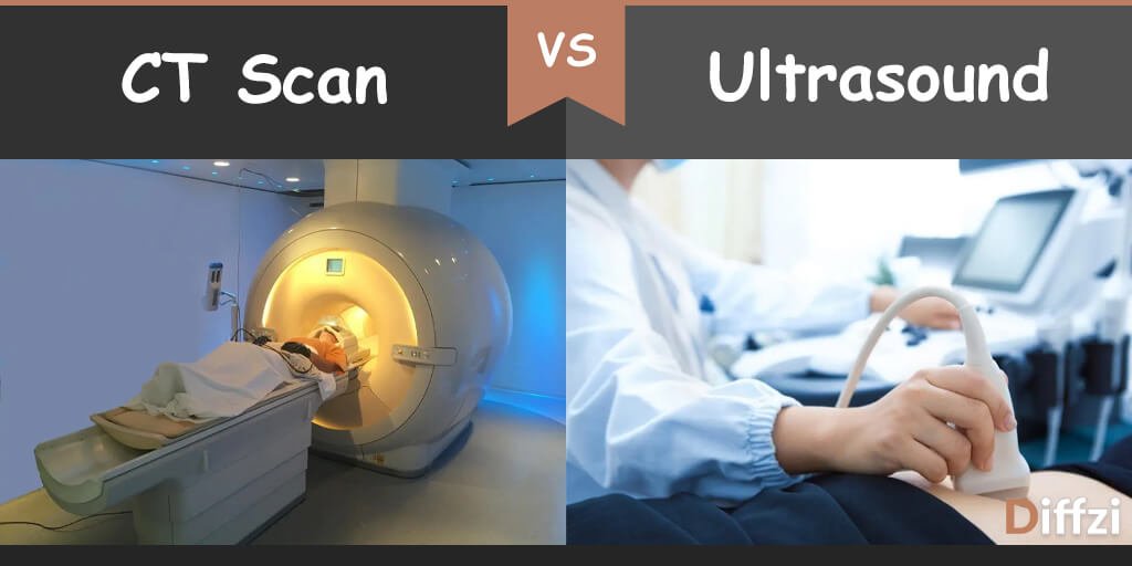 Chart ultrasound comparison Ultrasound vs.